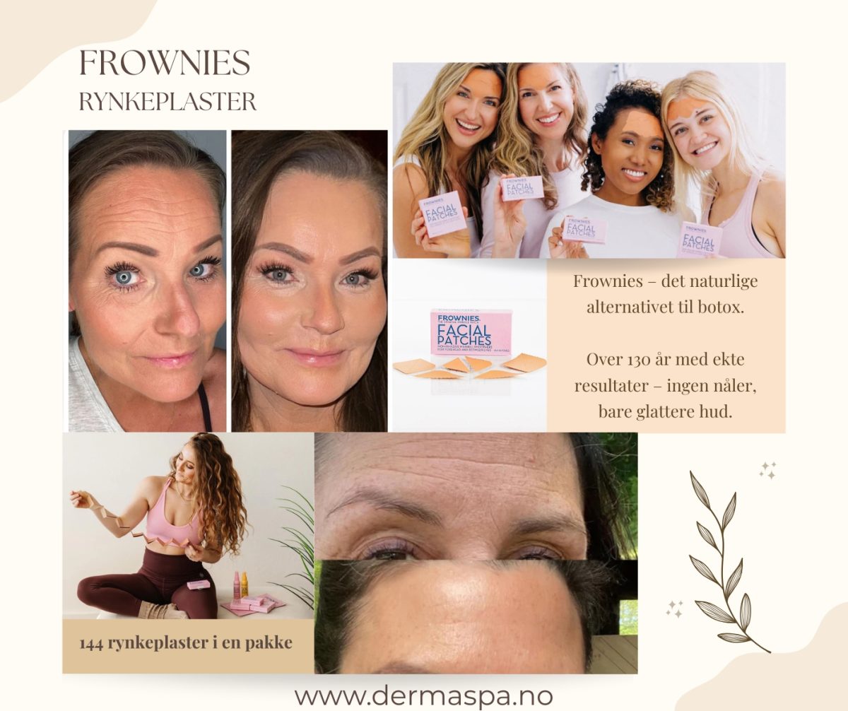 Frownies naturlig botox alternativ001